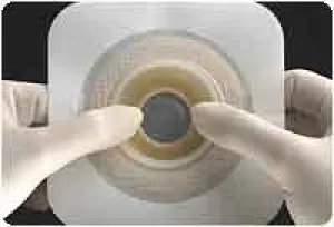 Natura® Durahesive® Skin Barrier, Tan, Moldable Stoma Opening 1-1/4" - 1-3/4" (33mm - 45mm), Flange 2-3/4" (70mm) - Box of 10